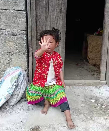 Cấp bách! Giúp đỡ trẻ bị bỏng sâu