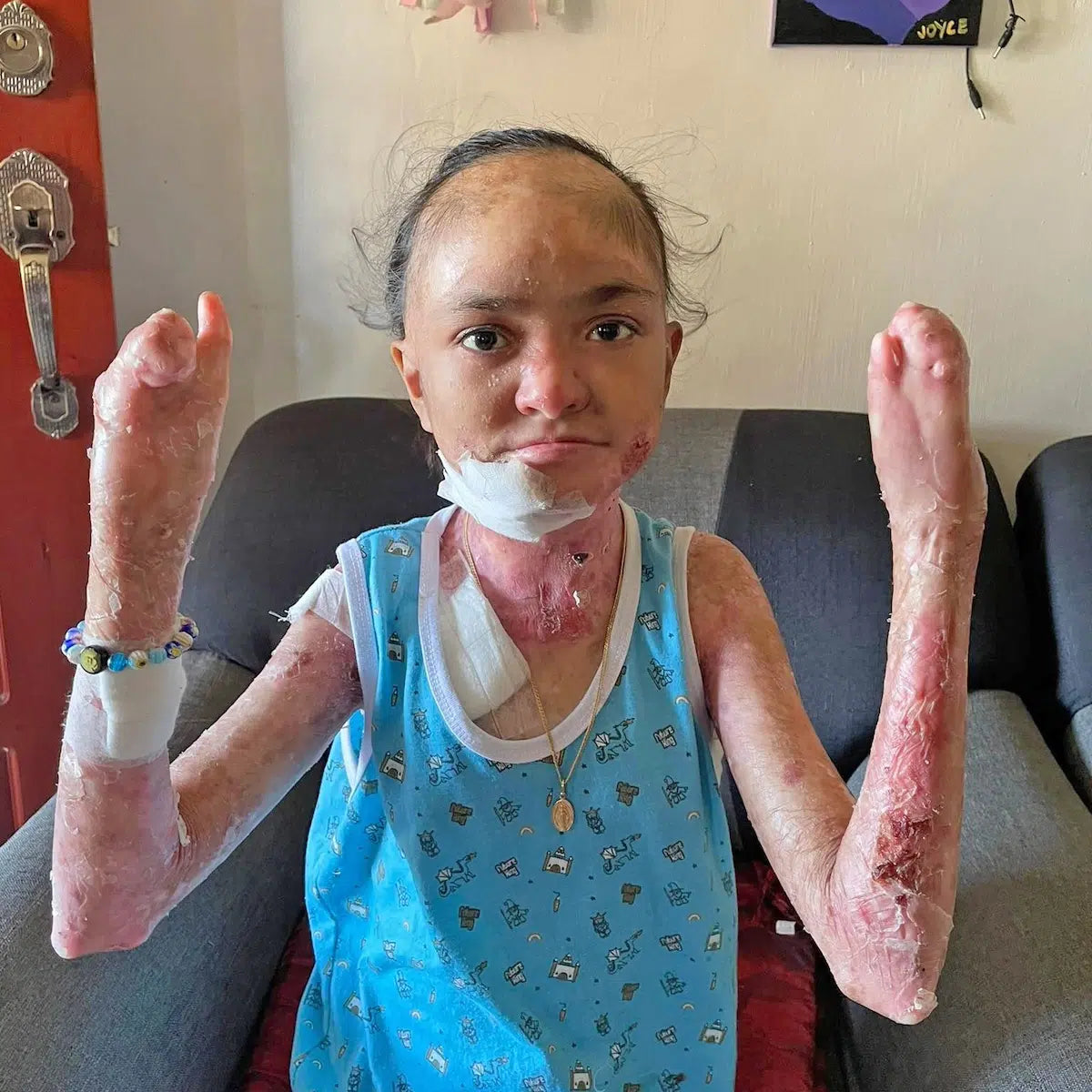 Please Donate To Help Save Joyce's Life And Reduce Her Pain