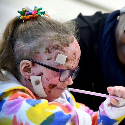Epidermolysis Bullosa Charity, Your Donations Save Lives