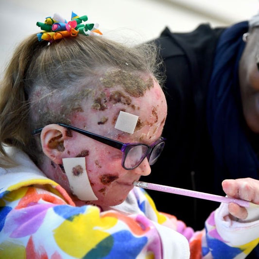 Epidermolysis Bullosa Charity, Your Donations Save Lives